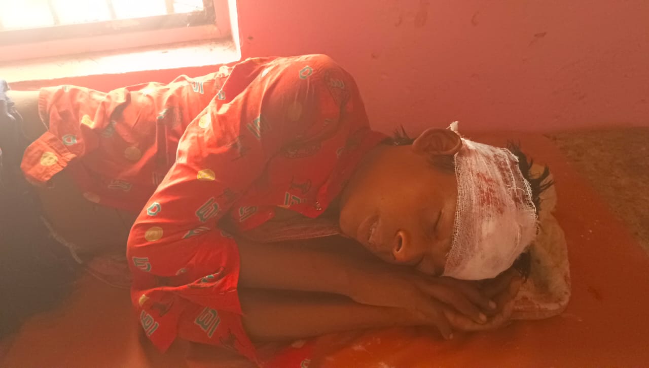 मशीन से टूटे लोहे से युवक घायल, रेफर